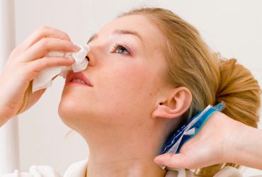 Woman treating a nosebleed
